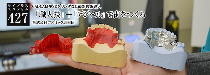 [サイプラススペシャル]427 「職人技」＋「デジタル」で歯をつくる CADCAMや3Dプリンタなど最新技術導入