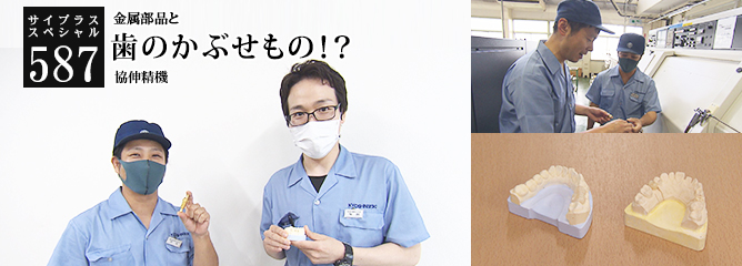 [サイプラススペシャル]587 歯のかぶせもの！？ 金属部品と